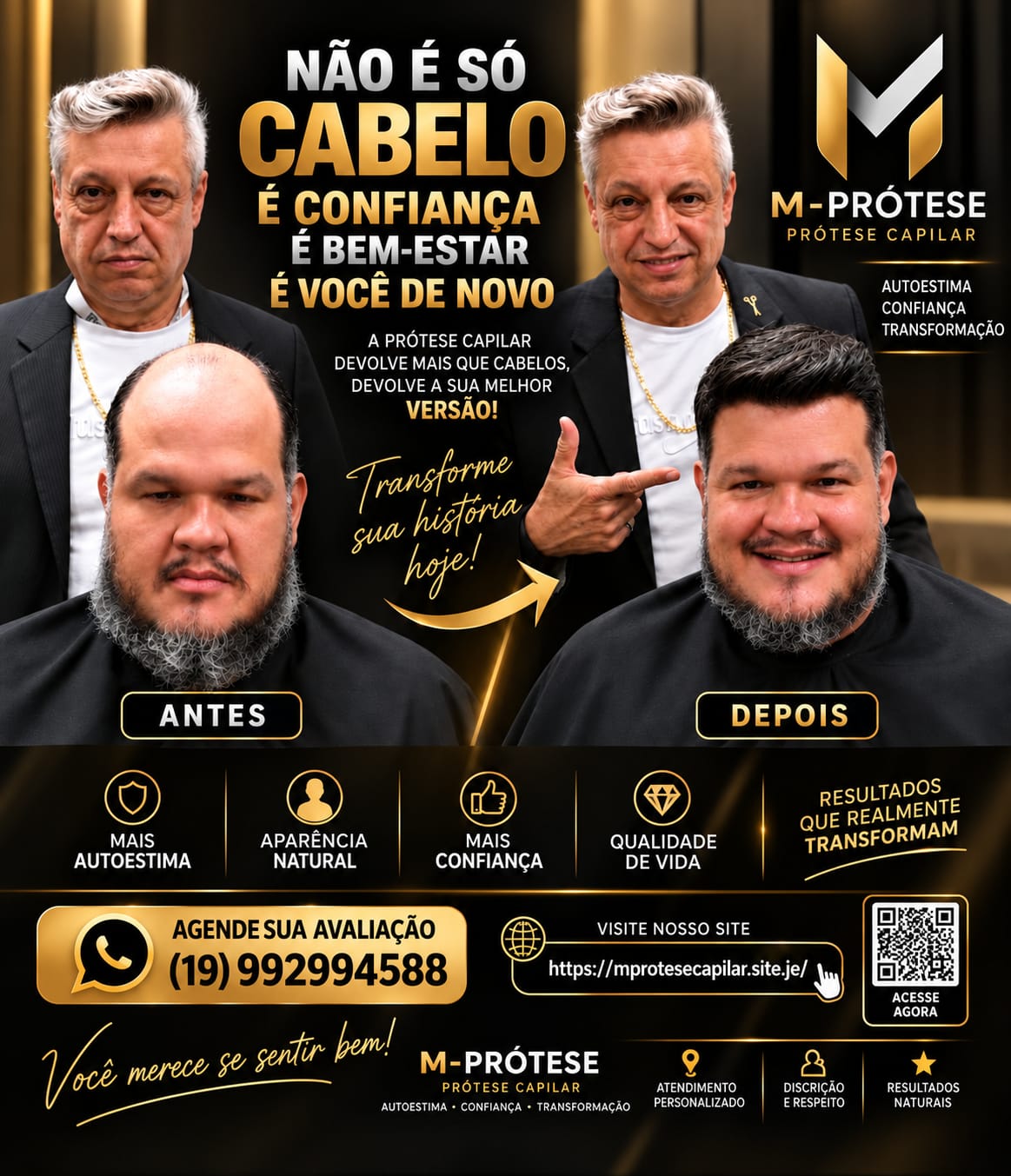 Prótesis capilar 9