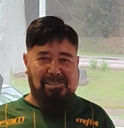 Prótesis capilar 11